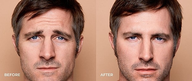 Before and after facial transformation comparison.