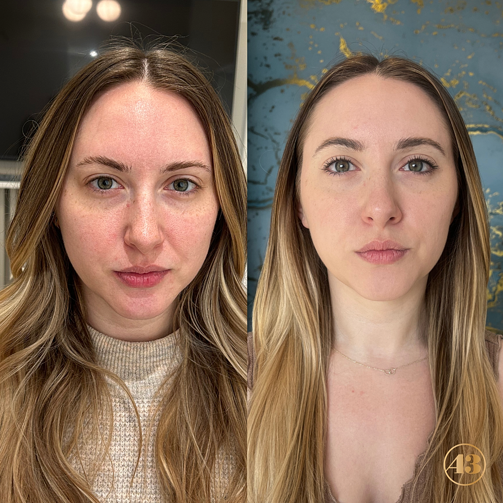 Wedding Skin Prep Before & After