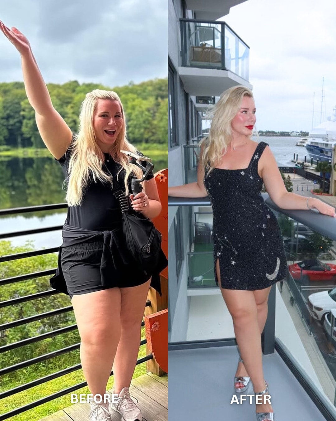 Weight Loss Injections Before & After